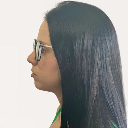 Crystal Elite Vision Multifocal Glasses